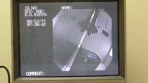 Monitor showing view through the endoscope lying on the table waiting to start. 