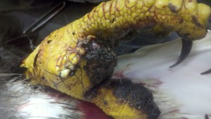 The toe had to be amputated, but she should still be released without issues.